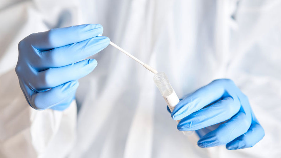 Antigentest Labor Test